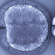 Illustration for article titled Even With IVF, Underweight Women Struggle To Conceive